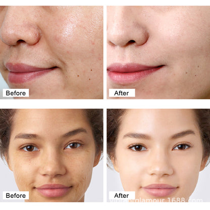 Retinol Facial Cream