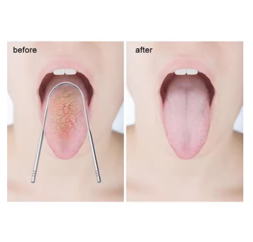 Tongue Cleaner